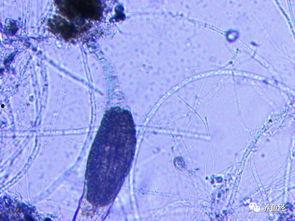 完全国产水霉100视频,揭秘我国水霉防治新篇章